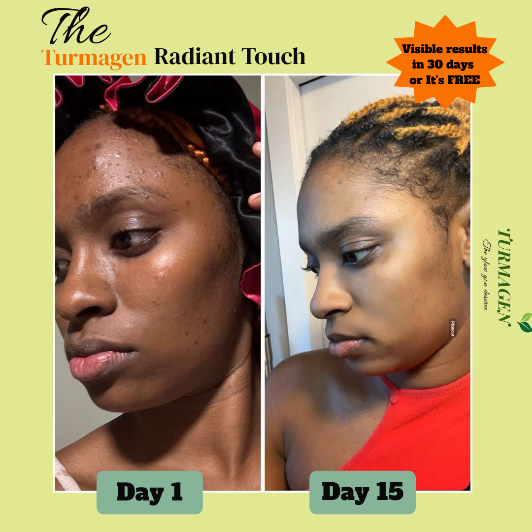 Kojic Acid & Turmeric Soap