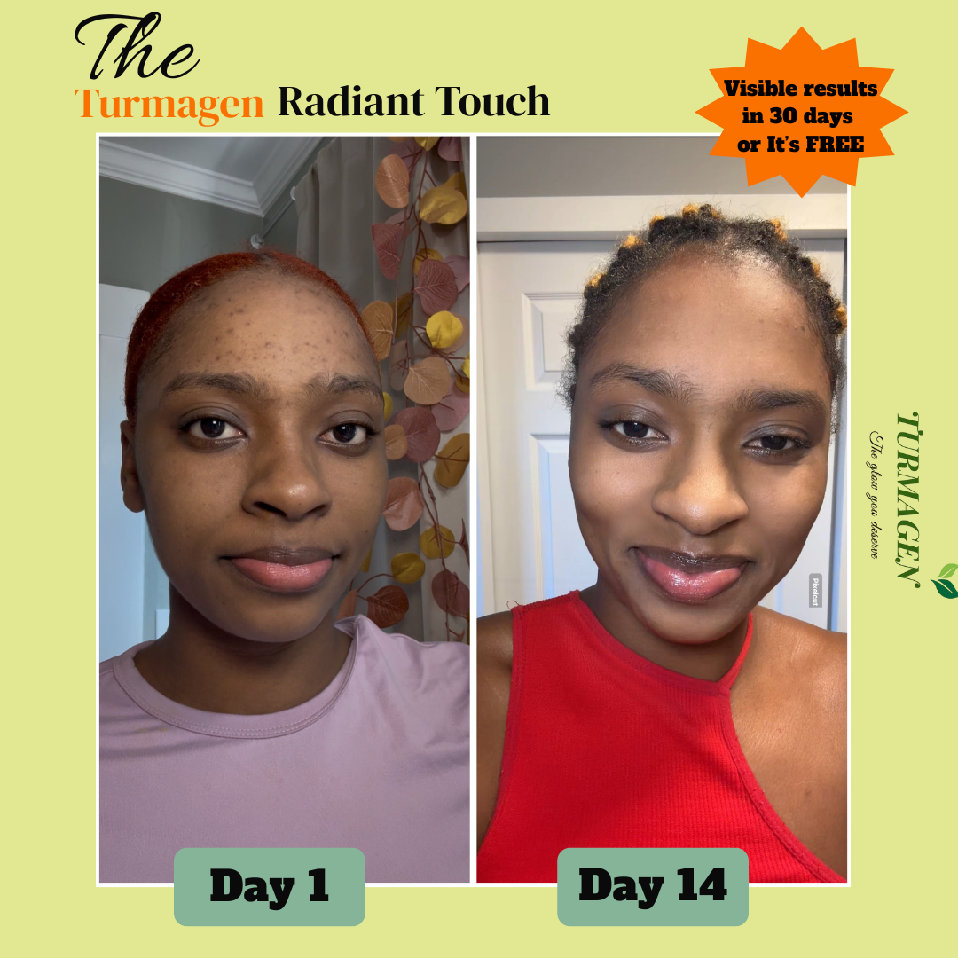 Kojic Acid & Turmeric Soap