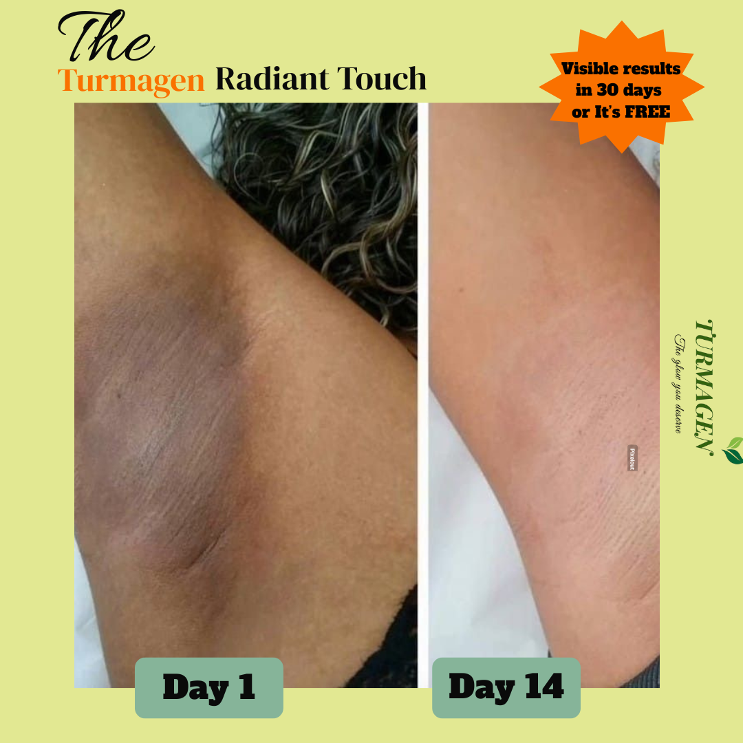 Kojic Acid & Turmeric Soap