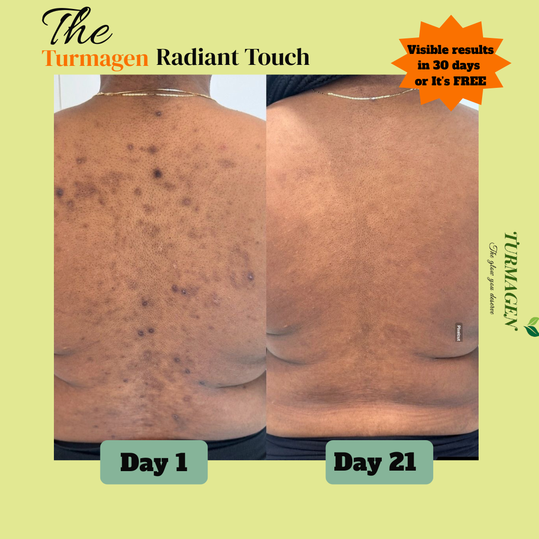 Kojic Acid & Turmeric Soap