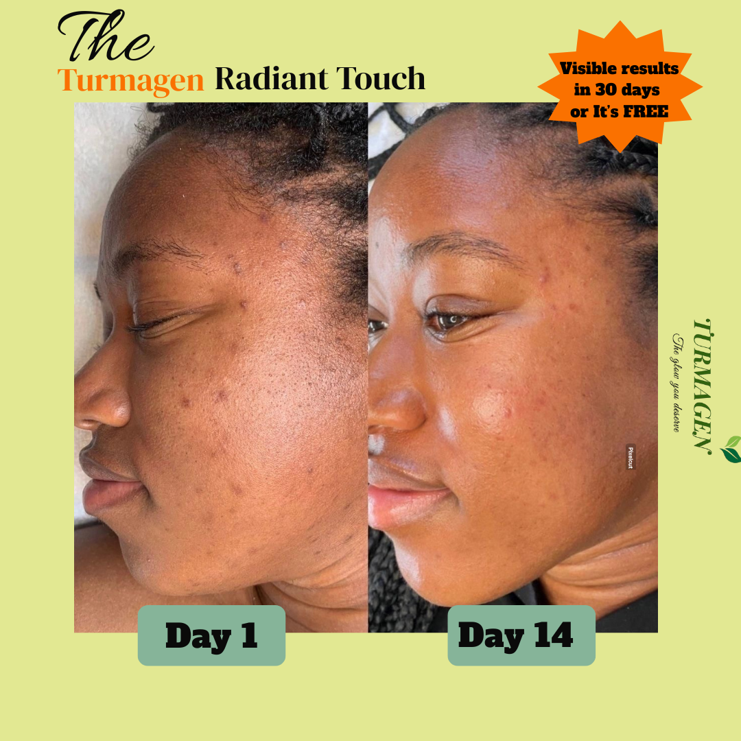 Kojic Acid & Turmeric Soap