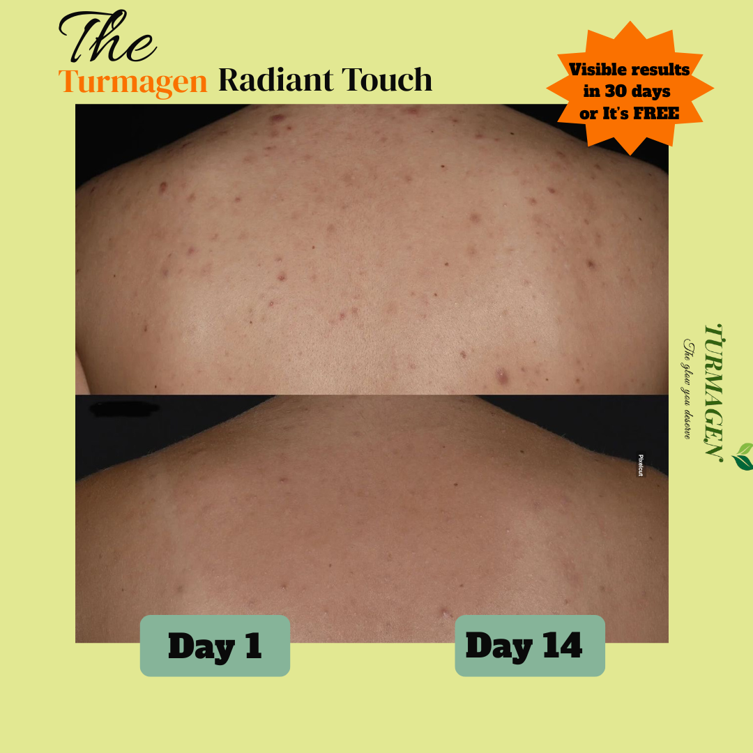 Kojic Acid & Turmeric Soap