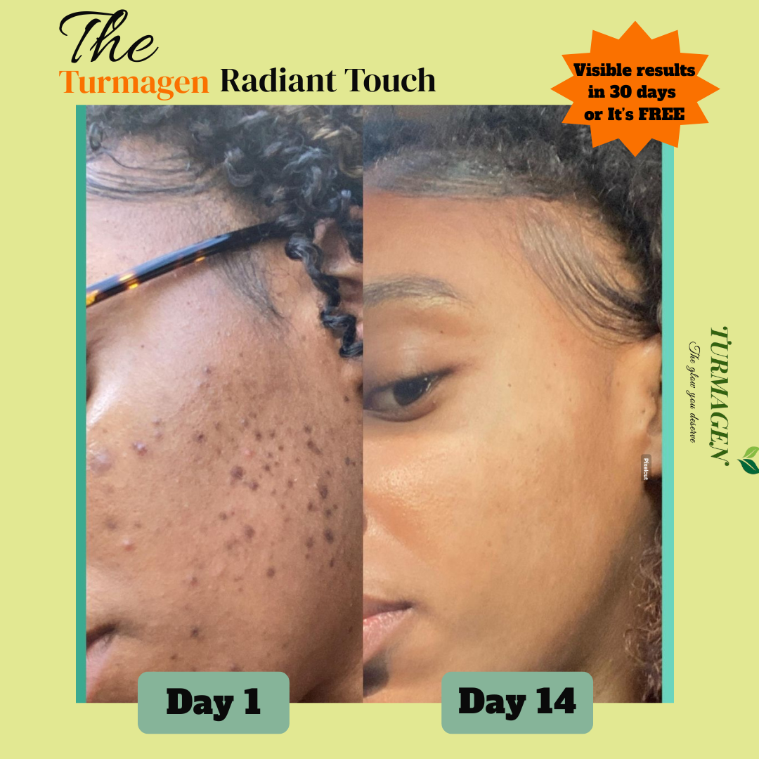 Kojic Acid & Turmeric Soap