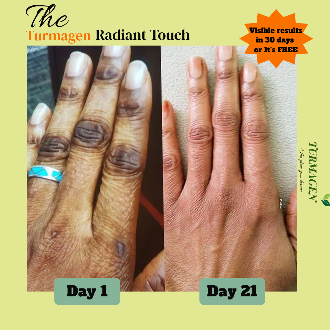 Kojic Acid & Turmeric Soap