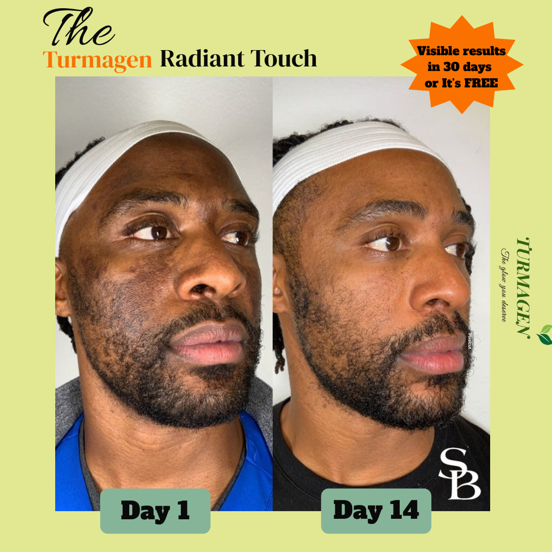 Kojic Acid & Turmeric Soap