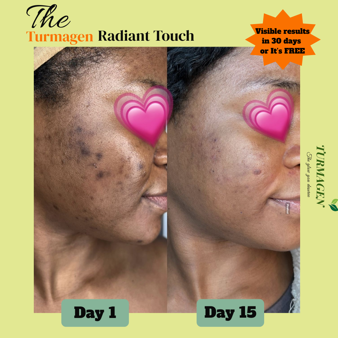 Kojic Acid & Turmeric Soap