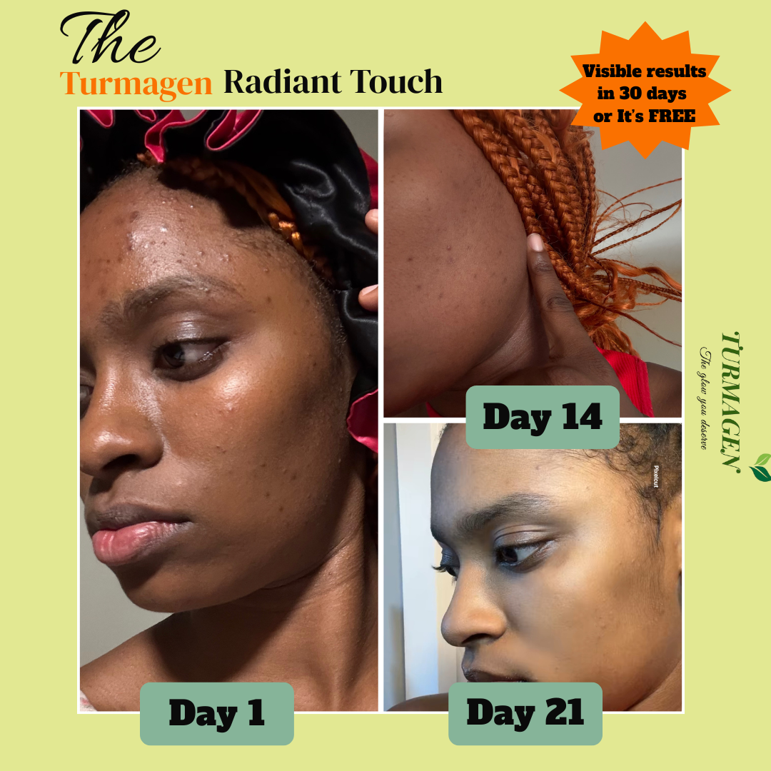 Kojic Acid & Turmeric Soap