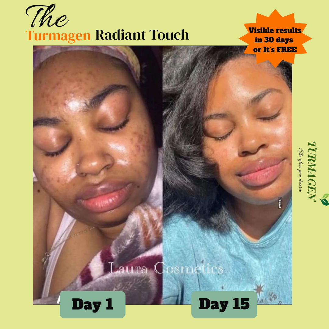 Dark Spot Serum for Normal Skin