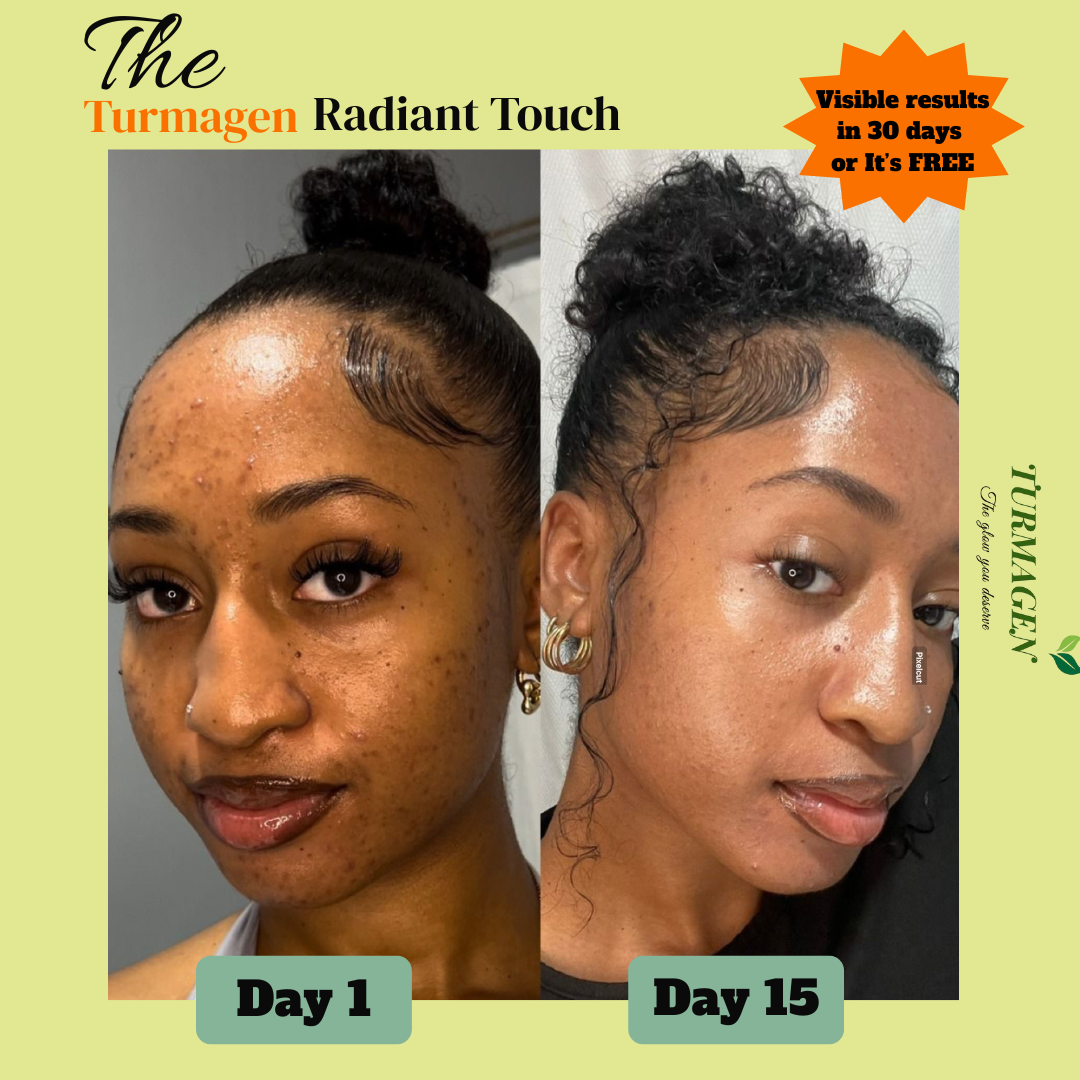 Dark Spot Serum for Normal Skin