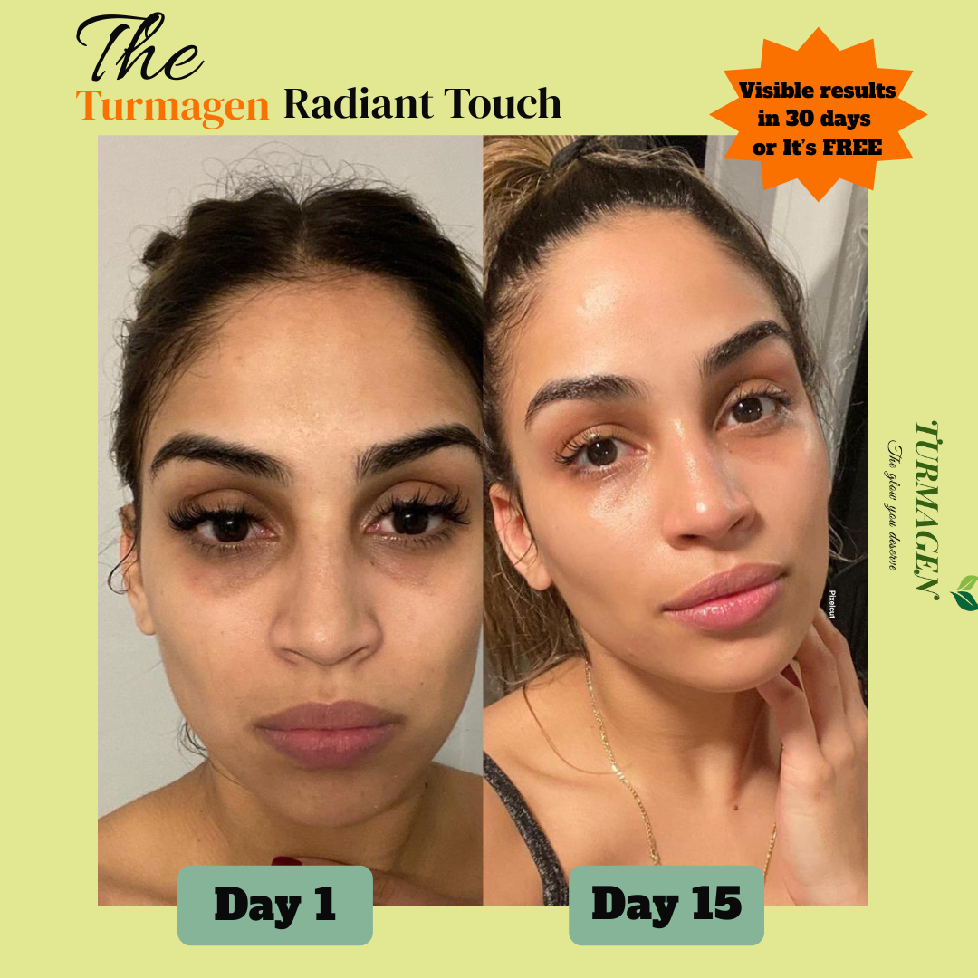 Dark Spot Serum for Normal Skin