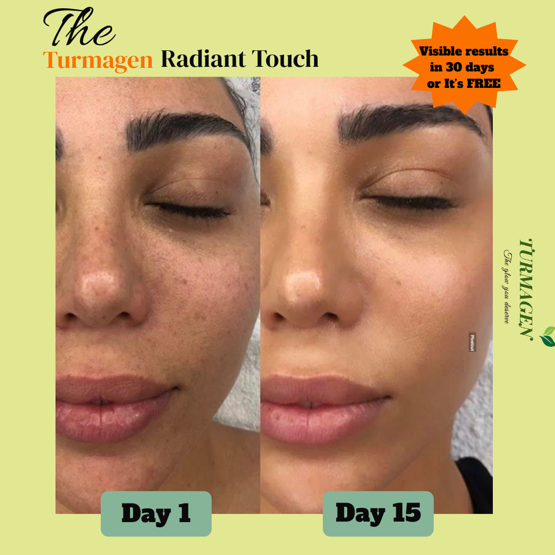 Dark Spot Serum for Normal Skin