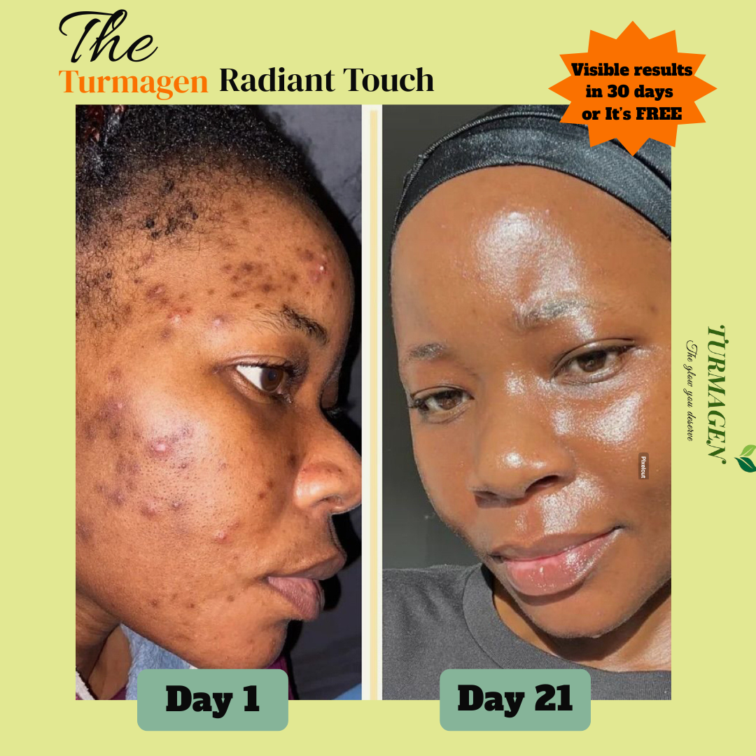 Dark Spot Serum for Normal Skin