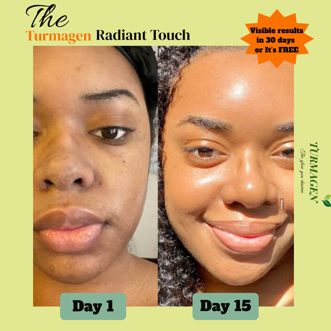 Dark Spot Serum for Normal Skin