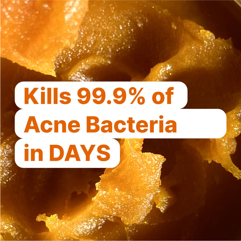 Kojic Acid & Turmeric Soap