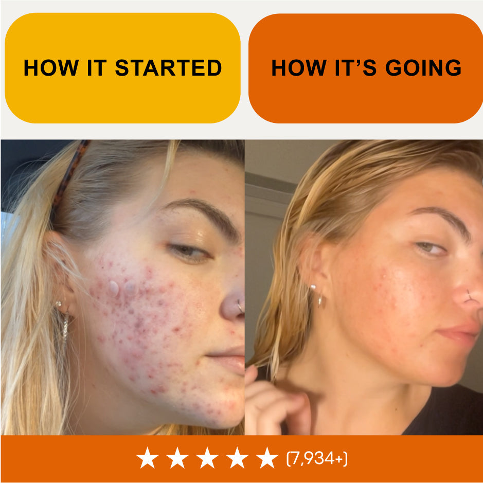 Kojic Acid & Turmeric Soap